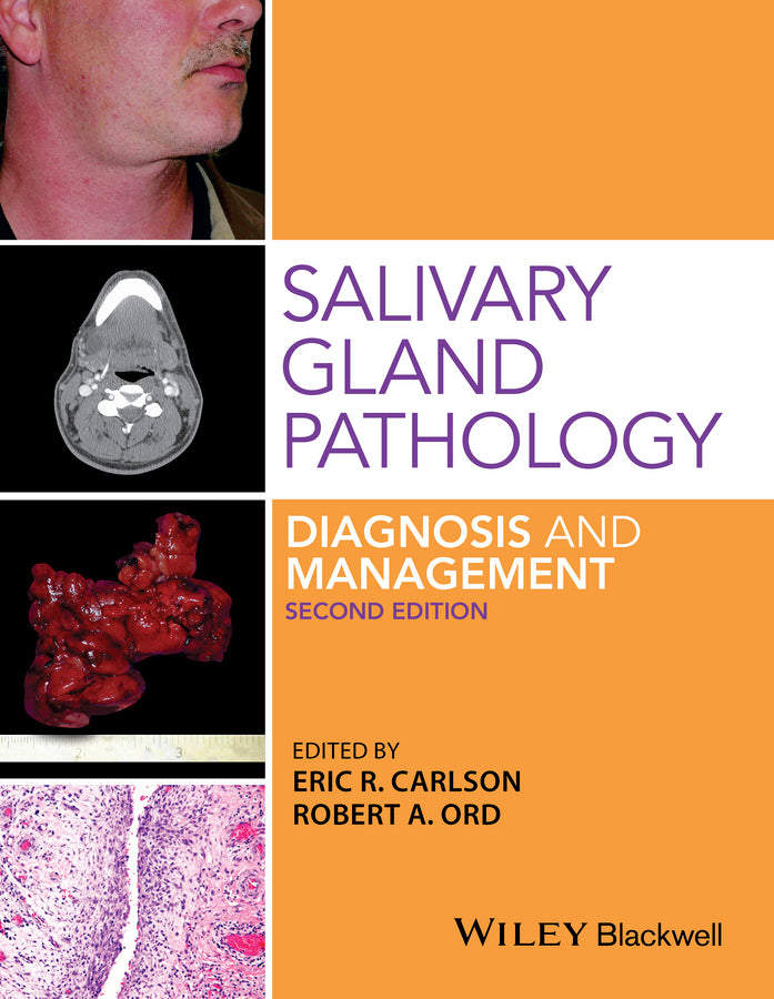 Salivary Gland Pathology