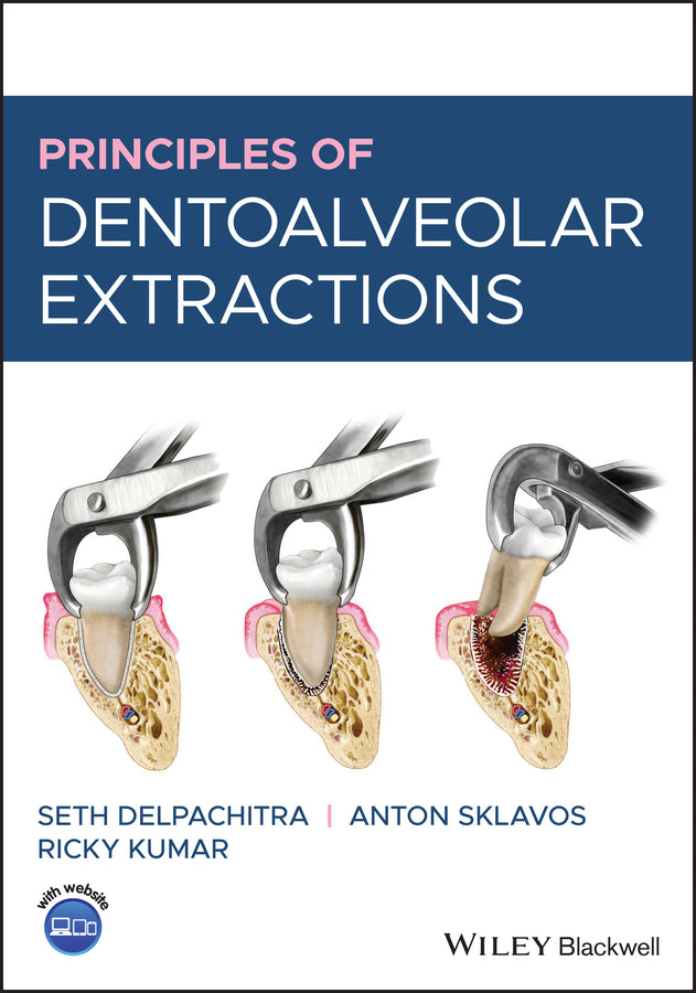 Principles of Dentoalveolar Extractions