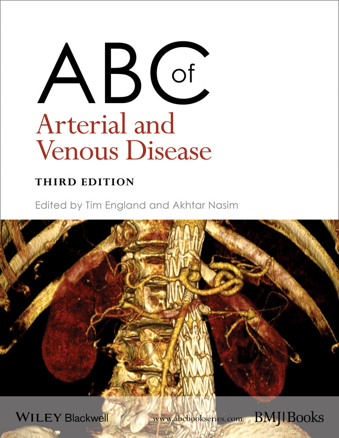 ABC of Arterial and Venous Disease