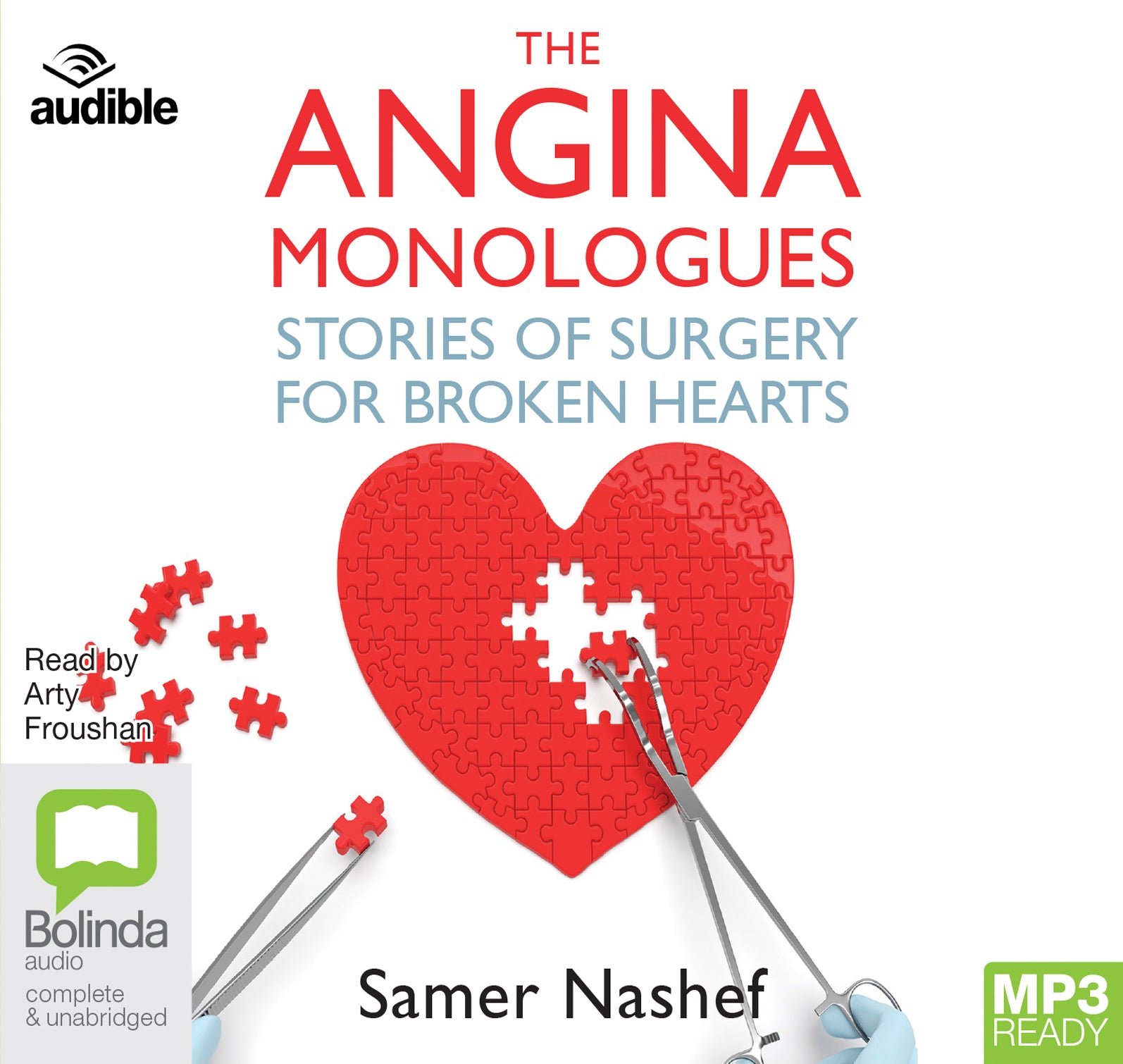 The Angina Monologues  - Unbridged Audio Book on MP3